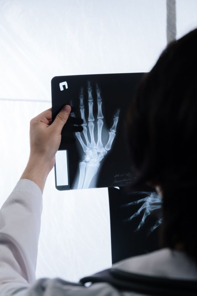 Doctor analyzing hand X-ray for signs of injury or bone health evaluation.
